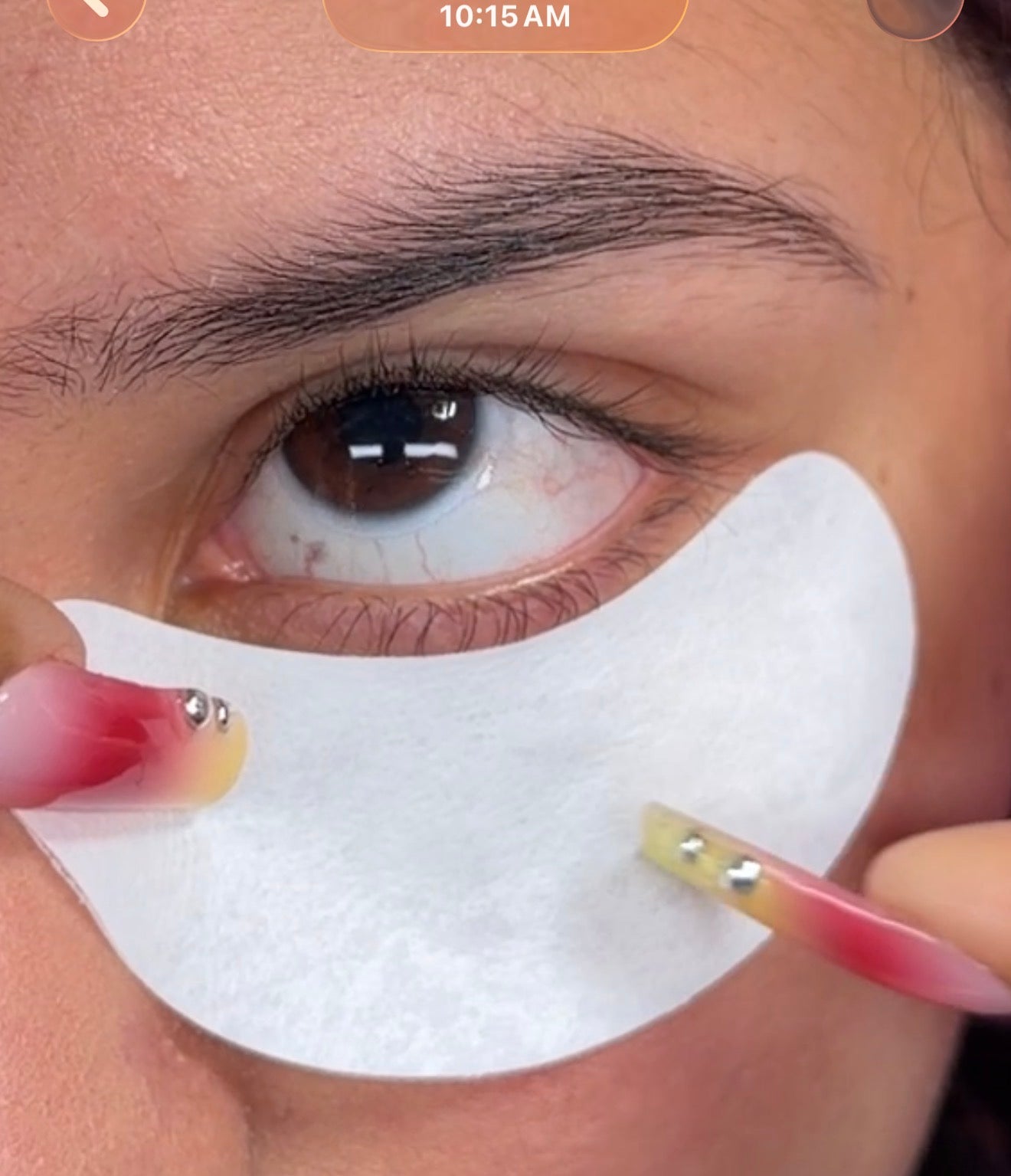 Eyepads