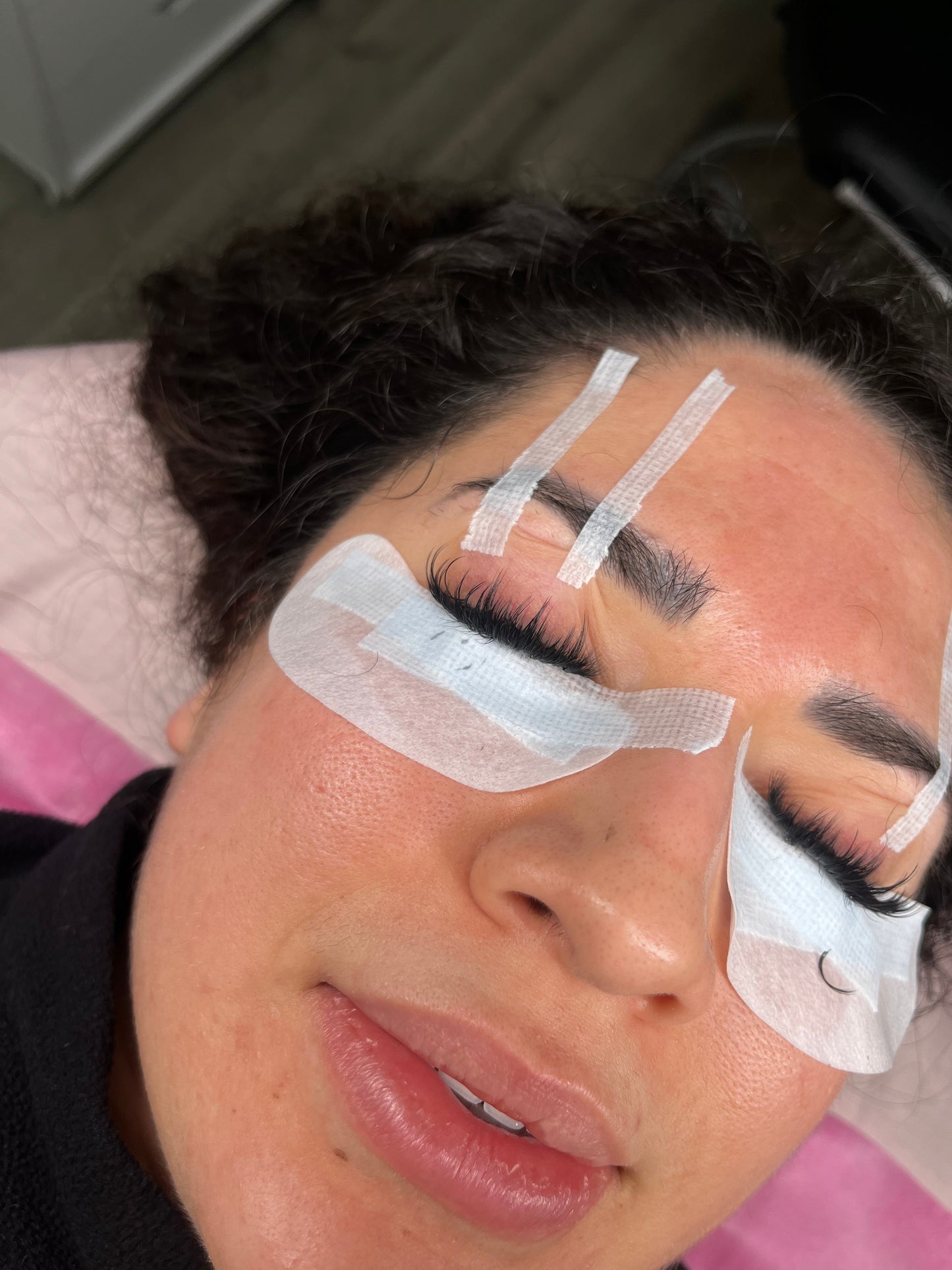 Eyepads